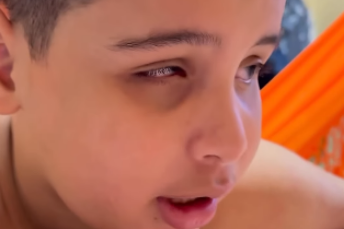 18