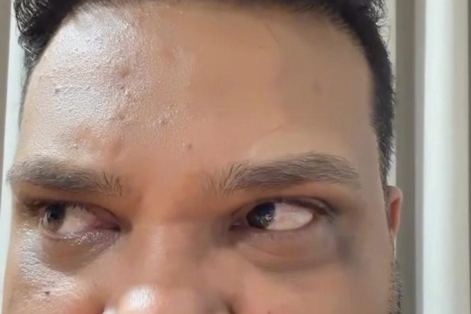 43